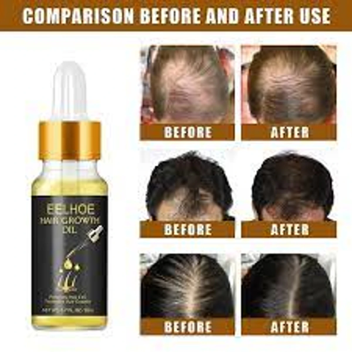 Eelhoe Hair Essential Oil for Scalp & Hair Care