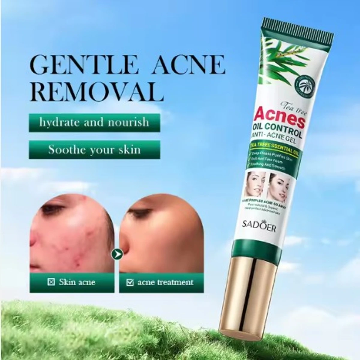 SADOER Tea Tree Oil Control Anti-Acnes Gel- 20g