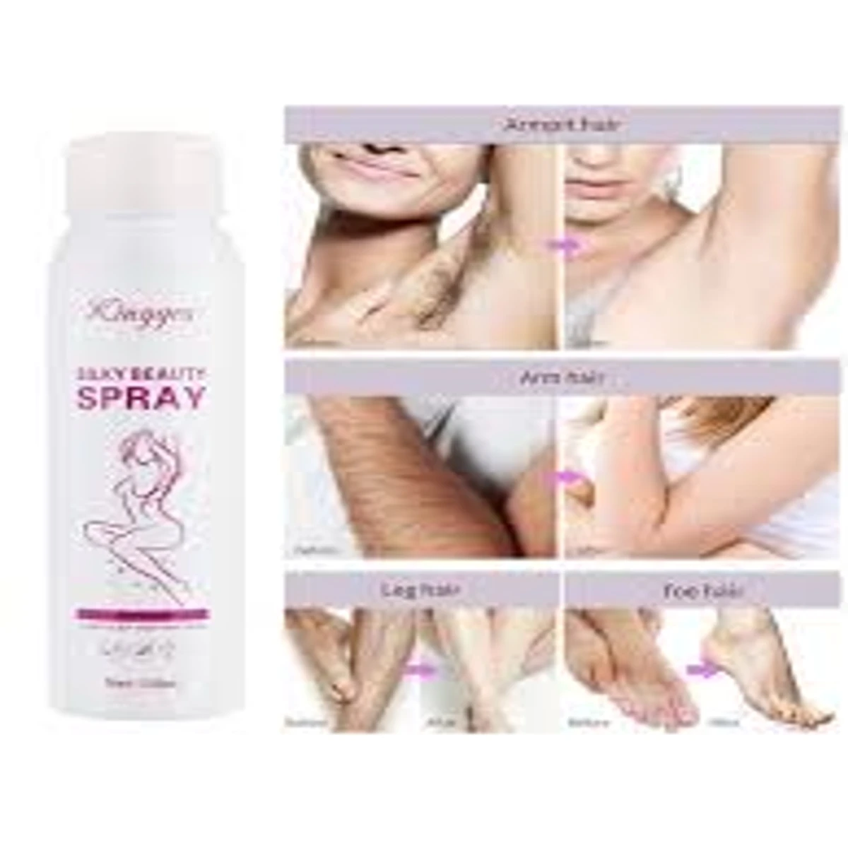 Hair Removal silky beauty Spray for Men and Women Skin Care (2pcs) ২ পিস অর্ডার করলে ডেলিভারি চার্জ ফ্রি