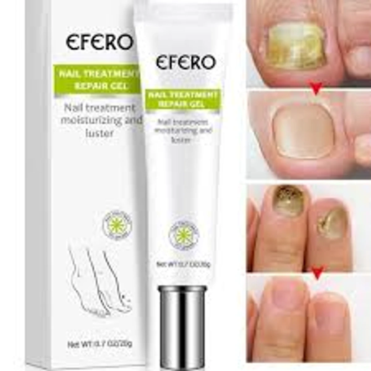 Fungal Removal Nail Treatment