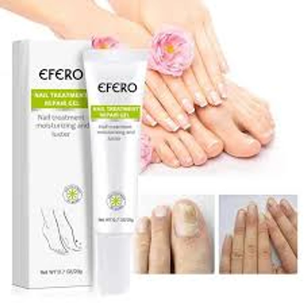 Fungal Removal Nail Treatment