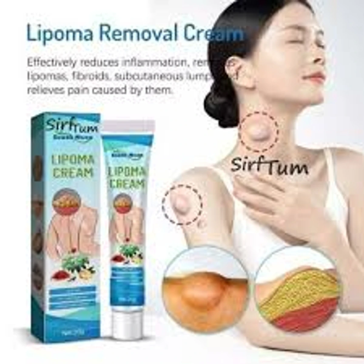 Lipoma Removal Cream Treatment Relieve