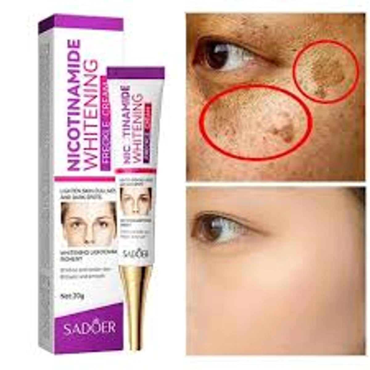 Freckle Removal Cream Moisturizing Moisturizing